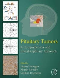 Pituitary Tumors: A Comprehensive and Interdisciplinary Approach – PDF ebook