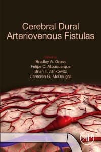 Cerebral Dural Arteriovenous Fistulas – PDF ebook
