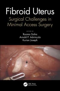 Fibroid Uterus: Surgical Challenges in Minimal Access Surgery 1st Edition – PDF ebook