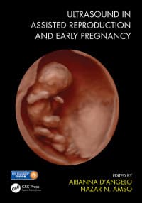 Ultrasound in Assisted Reproduction and Early Pregnancy 1st Edition – PDF ebook