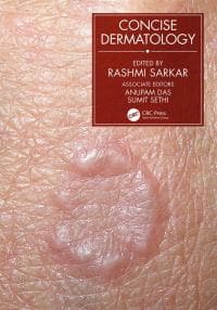 Concise Dermatology 1st Edition – PDF ebook