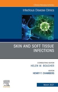 Skin and Soft Tissue Infections, An Issue of Infectious Disease Clinics of North America – PDF ebook