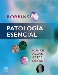 Kumar. Robbins patología esencial – PDF ebook