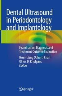 Dental Ultrasound in Periodontology and Implantology: Examination, Diagnosis and Treatment Outcome Evaluation 1st Edition – PDF ebook
