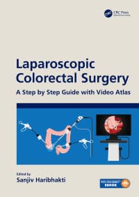 Laparoscopic Colorectal Surgery: A Step by Step Guide with Video Atlas 1st Edition – PDF ebook