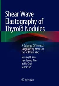Shear Wave Elastography of Thyroid Nodules: A Guide to Differential Diagnosis by Means of the Stiffness Map – PDF ebook