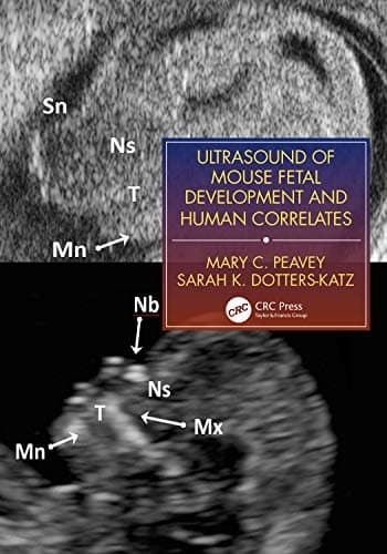 Ultrasound of Mouse Fetal Development and Human Correlates – PDF ebook