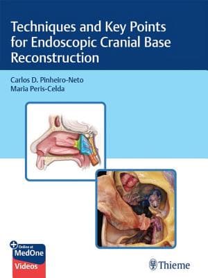 Techniques and Key Points for Endoscopic Cranial Base Reconstruction – PDF ebook