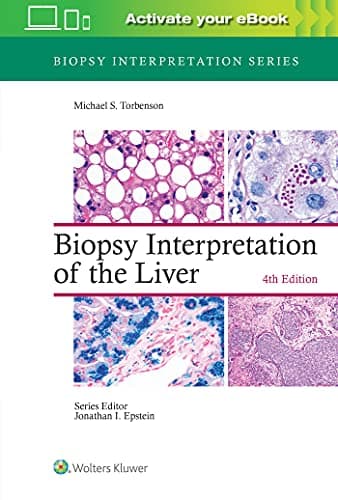 Biopsy Interpretation of the Liver (Biopsy Interpretation Series), 4th Edition – PDF ebook