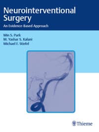 Neurointerventional Surgery: An Evidence-Based Approach – PDF ebook