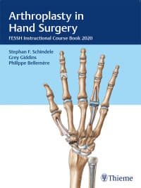 Arthroplasty in Hand Surgery: FESSH Instructional Course Book 2020 – PDF ebook