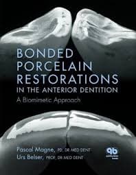 Bonded Porcelain Restorations in the Anterior Dentition A Biomimetic Approach – PDF ebook