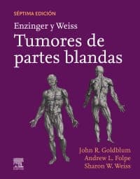 Enzinger y Weiss. Tumores de partes blandas 7th Edition – PDF ebook