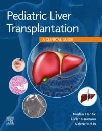 Pediatric Liver Transplantation: A Clinical Guide – PDF ebook
