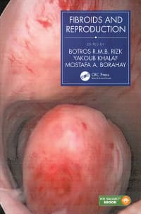 Fibroids and Reproduction 1st Edition – PDF ebook