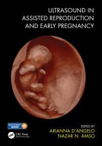 Ultrasound in Assisted Reproduction and Early Pregnancy 1st Edition – PDF ebook