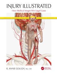 Injury Illustrated: How Medical Images Win Legal Cases 1st Edition – PDF ebook