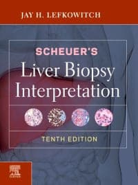 Scheuer’s Liver Biopsy Interpretation 10th Edition – PDF ebook