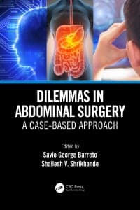 Dilemmas in Abdominal Surgery: A Case-Based Approach 1st Edition – PDF ebook