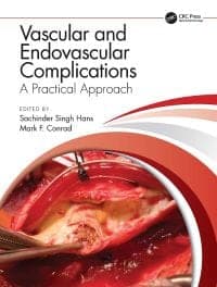 Vascular and Endovascular Complications: A Practical Approach 1st Edition – PDF ebook