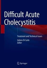 Difficult Acute Cholecystitis: Treatment and Technical Issues – PDF ebook