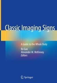 Classic Imaging Signs: A Guide to the Whole Body 1st Edition – PDF ebook