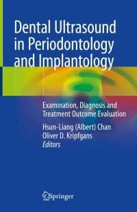Dental Ultrasound in Periodontology and Implantology: Examination, Diagnosis and Treatment Outcome Evaluation 1st Edition – PDF ebook