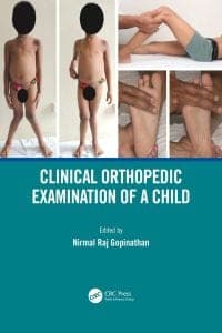 Clinical Orthopedic Examination of a Child 1st Edition – PDF ebook