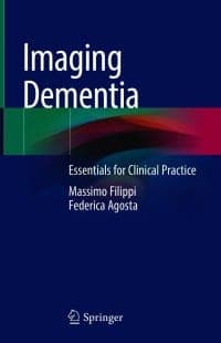 Imaging Dementia: Essentials for Clinical Practice – PDF ebook
