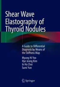 Shear Wave Elastography of Thyroid Nodules: A Guide to Differential Diagnosis by Means of the Stiffness Map – PDF ebook