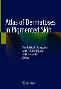 Atlas of Dermatoses in Pigmented Skin 1st Edition – PDF ebook