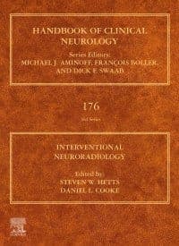 Interventional Neuroradiology 1st Edition – PDF ebook