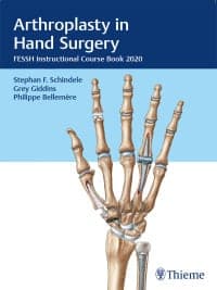 Arthroplasty in Hand Surgery: FESSH Instructional Course Book 2020 – PDF ebook