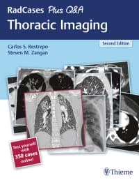 RadCases Plus Q&A Thoracic Imaging 2nd Edition – PDF ebook