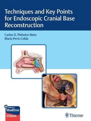 Techniques and Key Points for Endoscopic Cranial Base Reconstruction – PDF ebook