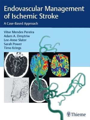 Endovascular Management of Ischemic Stroke: A Case-Based Approach – PDF ebook