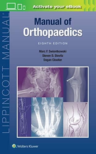 Manual of Orthopaedics (Lippincott Manual Series), 8th Edition – PDF ebook
