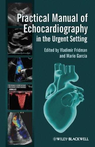 Practical Manual Of Echocardiography In The Urgent Setting – PDF ebook