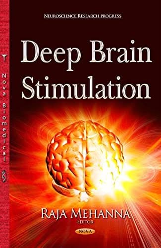 Deep Brain Stimulation - eBook