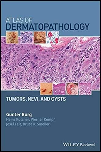 Atlas of Dermatopathology: Tumors, Nevi, and Cysts – PDF ebook