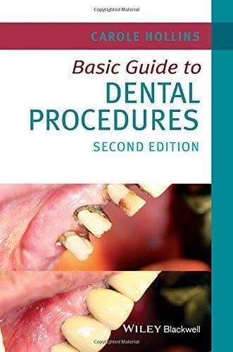 Basic Guide To Dental Procedures 2Nd Edition – PDF ebook