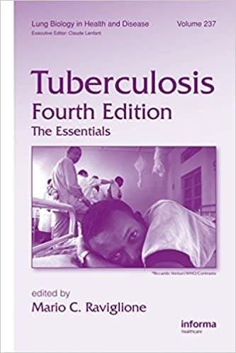 Tuberculosis: The Essentials (4th Edition) – PDF ebook