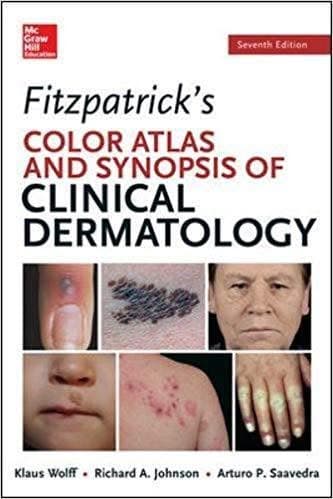 Fitzpatricks Color Atlas and Synopsis of Clinical Dermatology 7th Edition by Wolff – PDF ebook