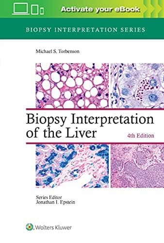 Biopsy Interpretation of the Liver (Biopsy Interpretation Series), 4th Edition – PDF ebook