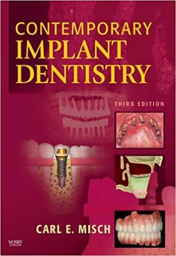 Contemporary Implant Dentistry (3rd Edition)  Free – PDF ebook