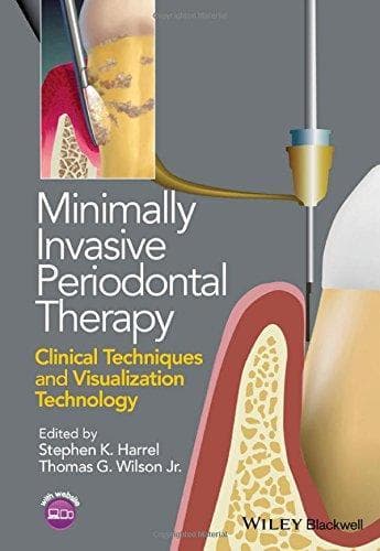 Minimally Invasive Periodontal Therapy Clinical Techniques And Visualization Technology – PDF ebook