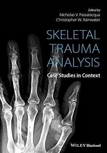 Skeletal Trauma Analysis Case Studies In Context – PDF ebook
