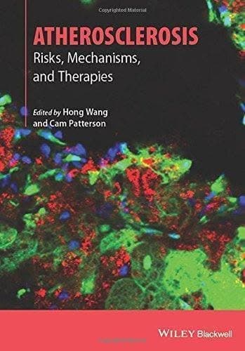 Atherosclerosis Risks Mechanisms And Therapies – PDF ebook