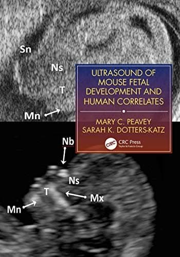 Ultrasound of Mouse Fetal Development and Human Correlates – PDF ebook