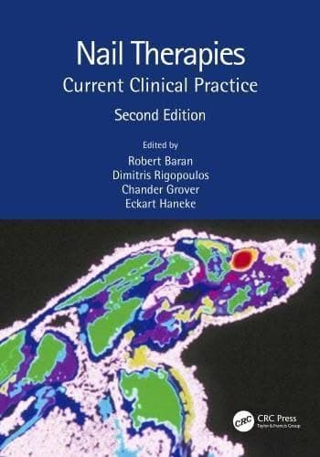 Nail Therapies Current Clinical Practice 2Nd Edition – PDF ebook